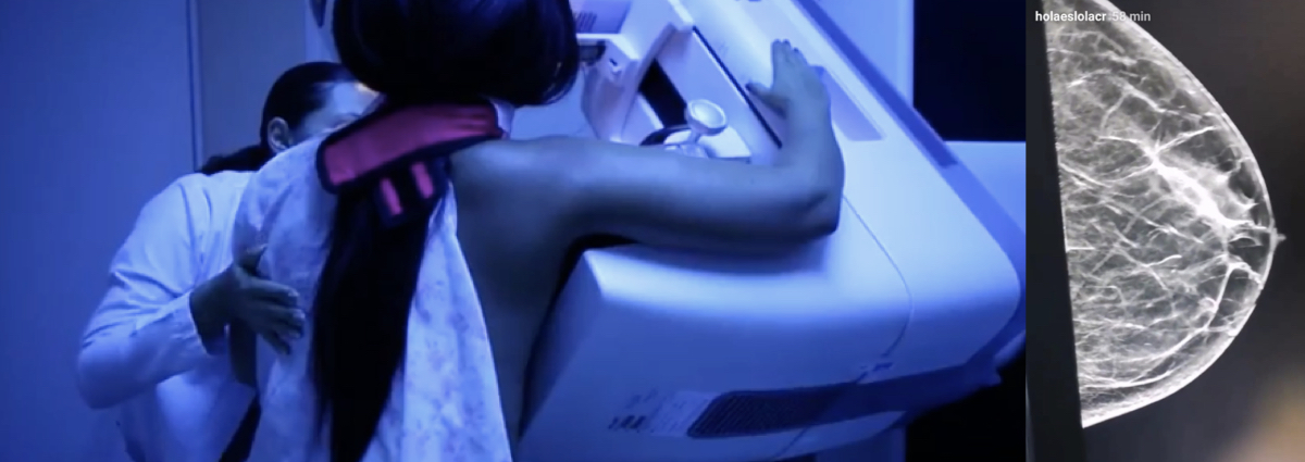 Tomosíntesis de mama (Mamografía 3D)